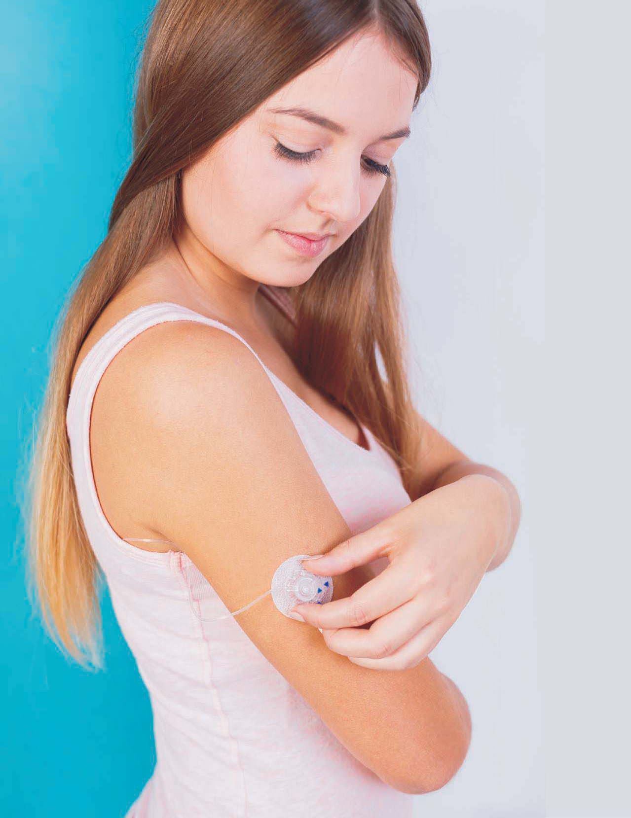 Glucose Monitoring In Diabetes