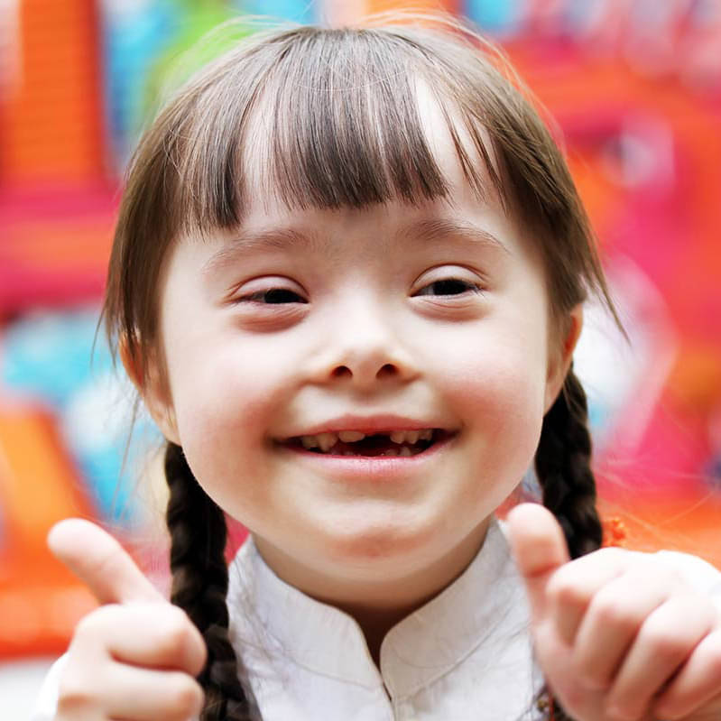 FACTS ABOUT DOWN'S SYNDROME